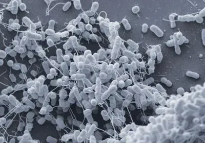 A scanning electron micrograph of a coculture of E. coli and Acinetobacter baylyi. Nanotubes can be seen extending from the E. coli. A scanning electron micrograph of a coculture of E. coli and Acinetobacter baylyi. Nanotubes can be seen extending from the E. coli.